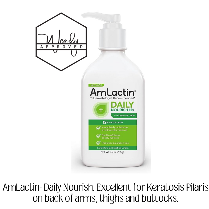Acne safe body lotion for those with Keratosis Pilaris. - Wendy Approved.